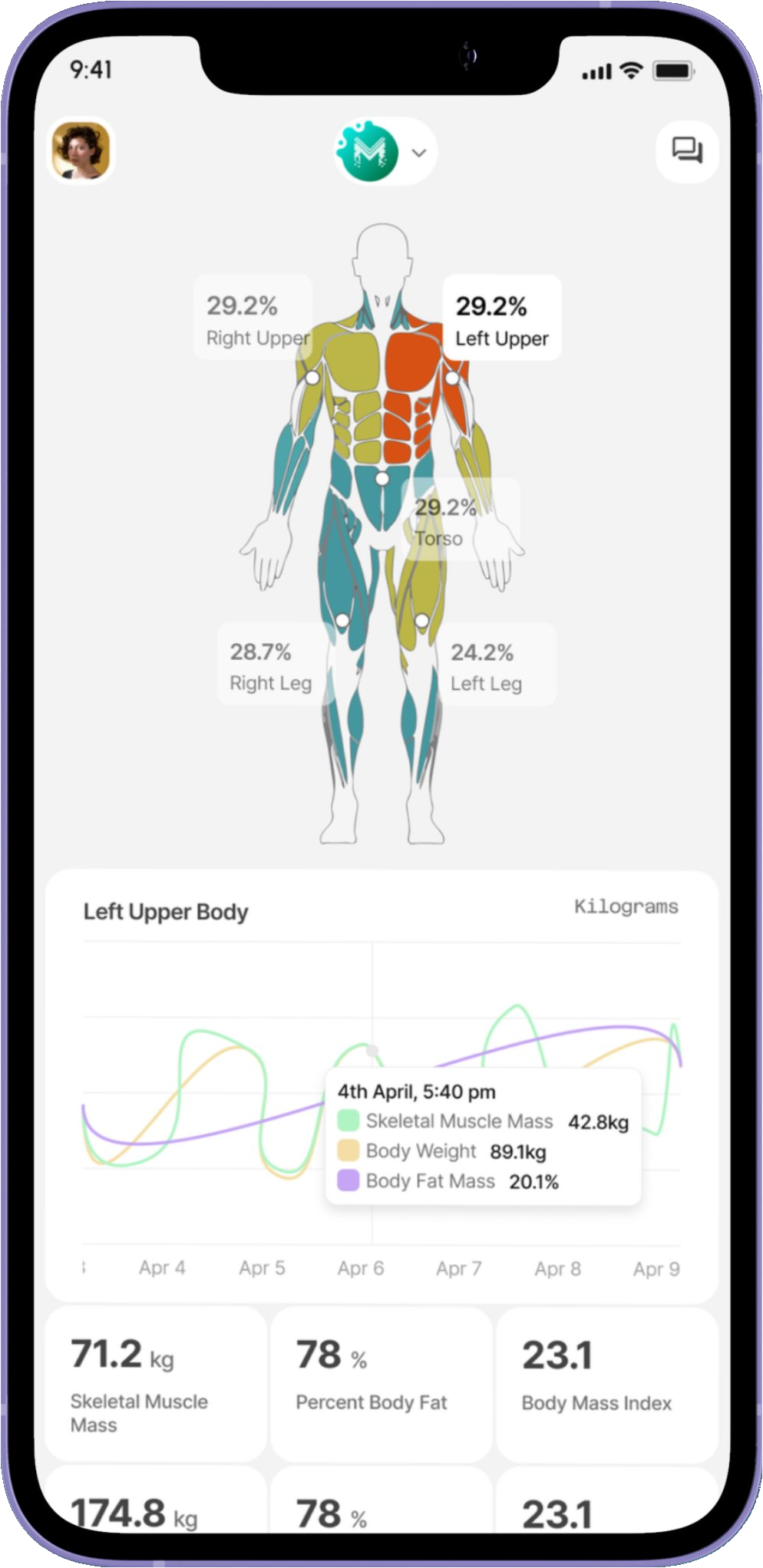 MetAi app showing body composition, muscle mapping, and health metrics